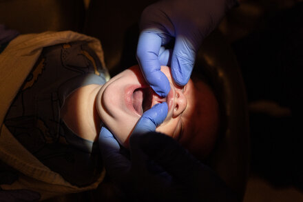 The Controversy Over Tongue Surgery for Infants