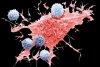 Innovative Cancer Treatment May Sometimes Cause Cancer, F.D.A. Says