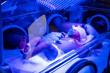 Did Your Baby Spend Time in the NICU? Tell Us About It.
